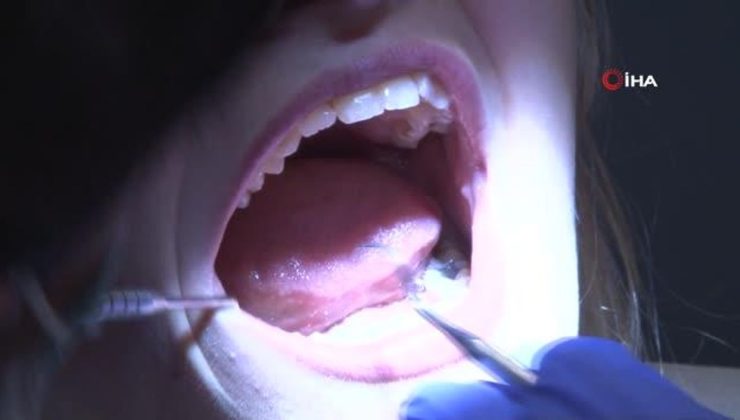 Diş beyazlatmada yanlışsız bildiğiniz yanlışlar diş kaybına sebep olabilir
