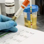 100 bin liraya duzmece idrar raporu 28 kisi gozaltina alindi IG4CP4Xc