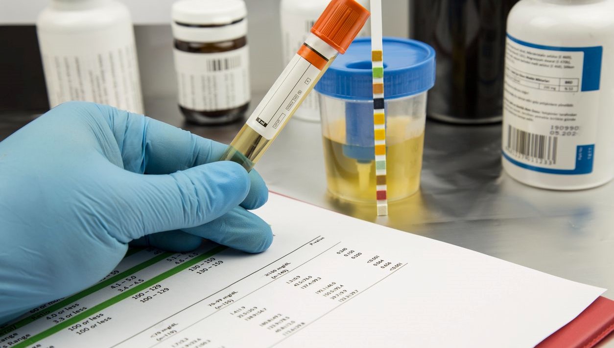 Sahte İdrar Raporu Şebekesi Çökertildi: 100 Bin Liralık Vurgun ve 28 Gözaltı 71 100 bin liraya duzmece idrar raporu 28 kisi gozaltina alindi IG4CP4Xc