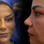 220 bin liraya estetik oldu hayati kabusa dondu PtP7HuX7