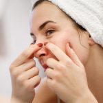 5 temel omur uslubu degisikligi sivilceleri kokunden kurutuyor 8LRDKFq3