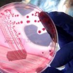 ap2a1 proteini nedir nasil baskilanir bilim insanlarindan yaslanmayi unutturan kesif wfTqRU17