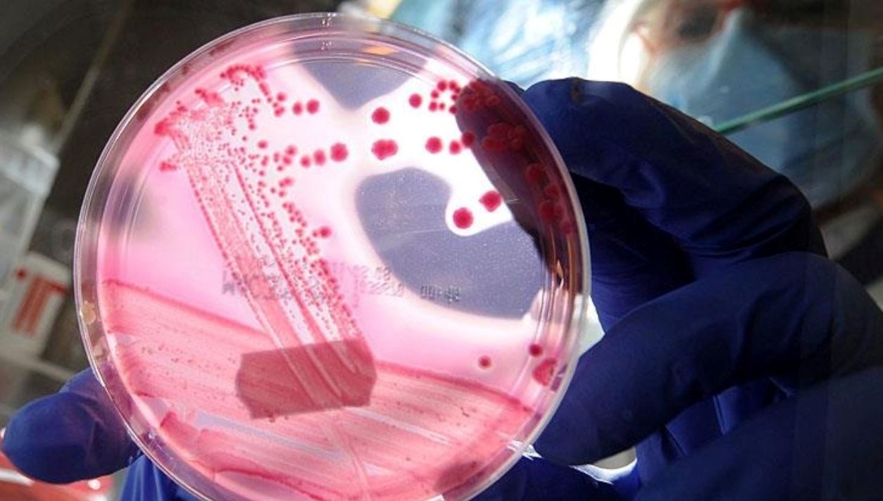 ap2a1 proteini nedir nasil baskilanir bilim insanlarindan yaslanmayi unutturan kesif wfTqRU17