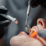 dis doktoruna giden 34 yasindaki bayan 90 dakika icinde oldu xyG6Veix