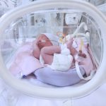 dogustan bagirsaginin bir kismi yoktu 3 binde 1 gorulen hastalikla dogan bebek pvidhDfj