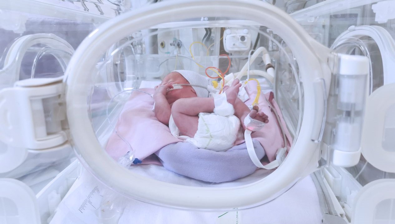 dogustan bagirsaginin bir kismi yoktu 3 binde 1 gorulen hastalikla dogan bebek pvidhDfj