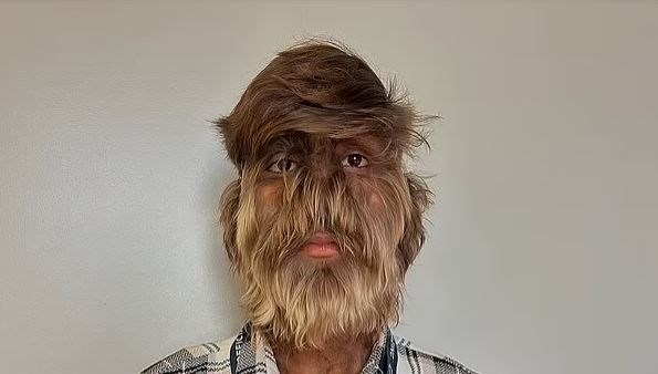 dunyanin en killi yuzu secildi kendimi seviyorum gorunusumu degistirmek istemiyorum