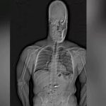 evvel caldi sonra yuttu 29 milyon liralik kupeler iade edildi EMej53lg