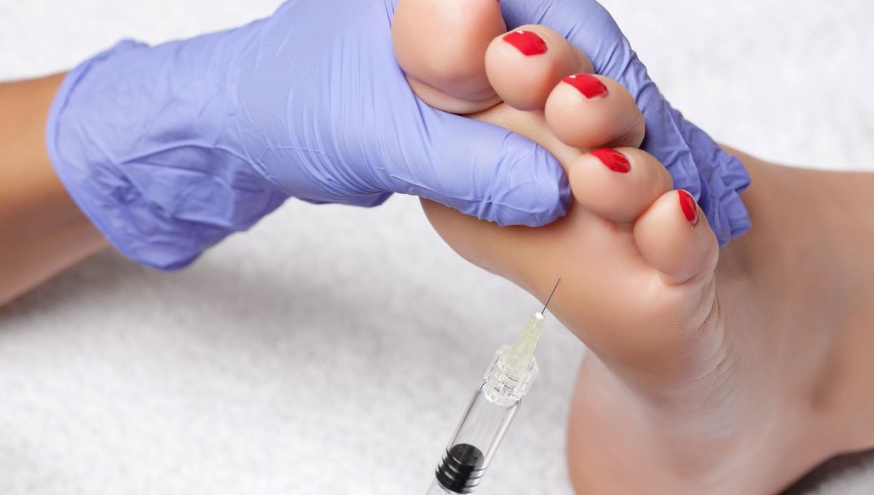 Hollywood yıldızlarının sırrı: Stiletto botoksu. 71 hollywood yildizlari ortasinda da taninan stiletto botoks nedir idbXIwIj