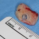 ihtilal niteliginde tedavi gorme engelli hastaya kendi disi yerlestirildi iY4qiHZc