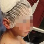 ispartata basibos sokak kopegi saldirisi 9 yasindaki cocuk mevtten dondu GD9M89JA