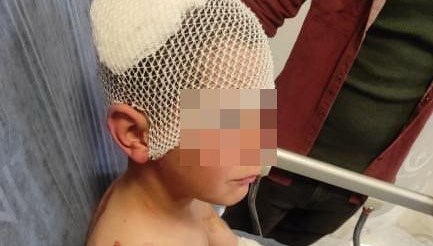 Isparta'da Köpek Dehşeti: 9 Yaşındaki Çocuk Ölümün Kıyısından Döndü 71 ispartata basibos sokak kopegi saldirisi 9 yasindaki cocuk mevtten dondu GD9M89JA