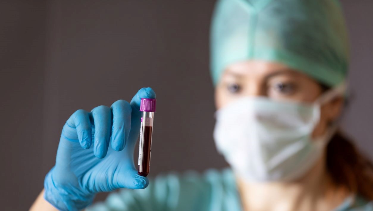 Kanser Riskini Artıran Kan Grupları Belirlendi: İşte Yüzde 55'lik Tehlike 69 kansere en yatkin kan kumeleri belirli oldu risk yuzde 55 daha fazla lggHwAhr