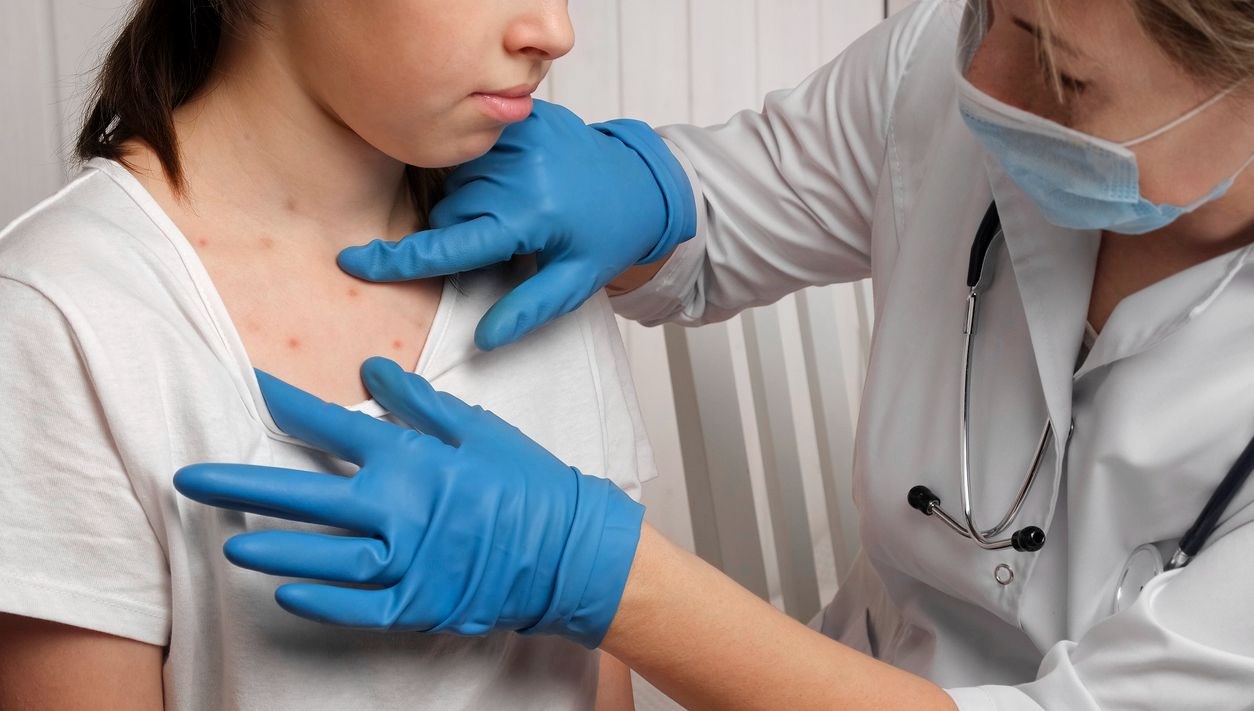 kizamik geri dondu dunya sihhat orgutunden uyandirma cagrisi