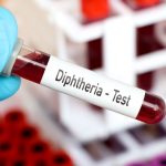 nijeryada difteri salgini mayis 2022den beri bin 319 kisi oldu Aj2Ll8W9