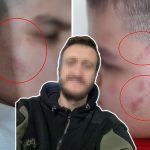 otizmli cocuga okulda dayak tezi 3bS8dKzk