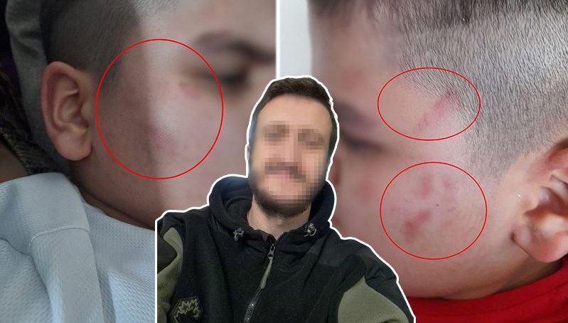 Otizmli Öğrencinin Okulda Şiddet Deneyimi: Kapsamlı Bir İnceleme 71 otizmli cocuga okulda dayak tezi 3bS8dKzk