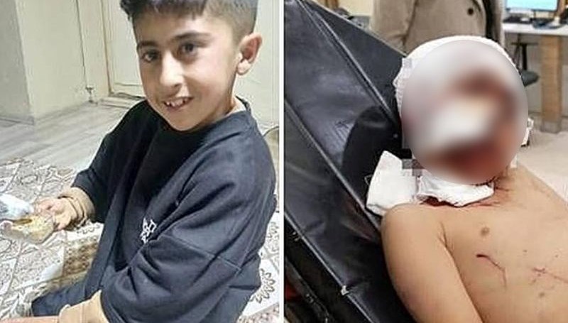 sokak kopeklerinin saldirdigimurat agir yaralandi 1ptc5Lia