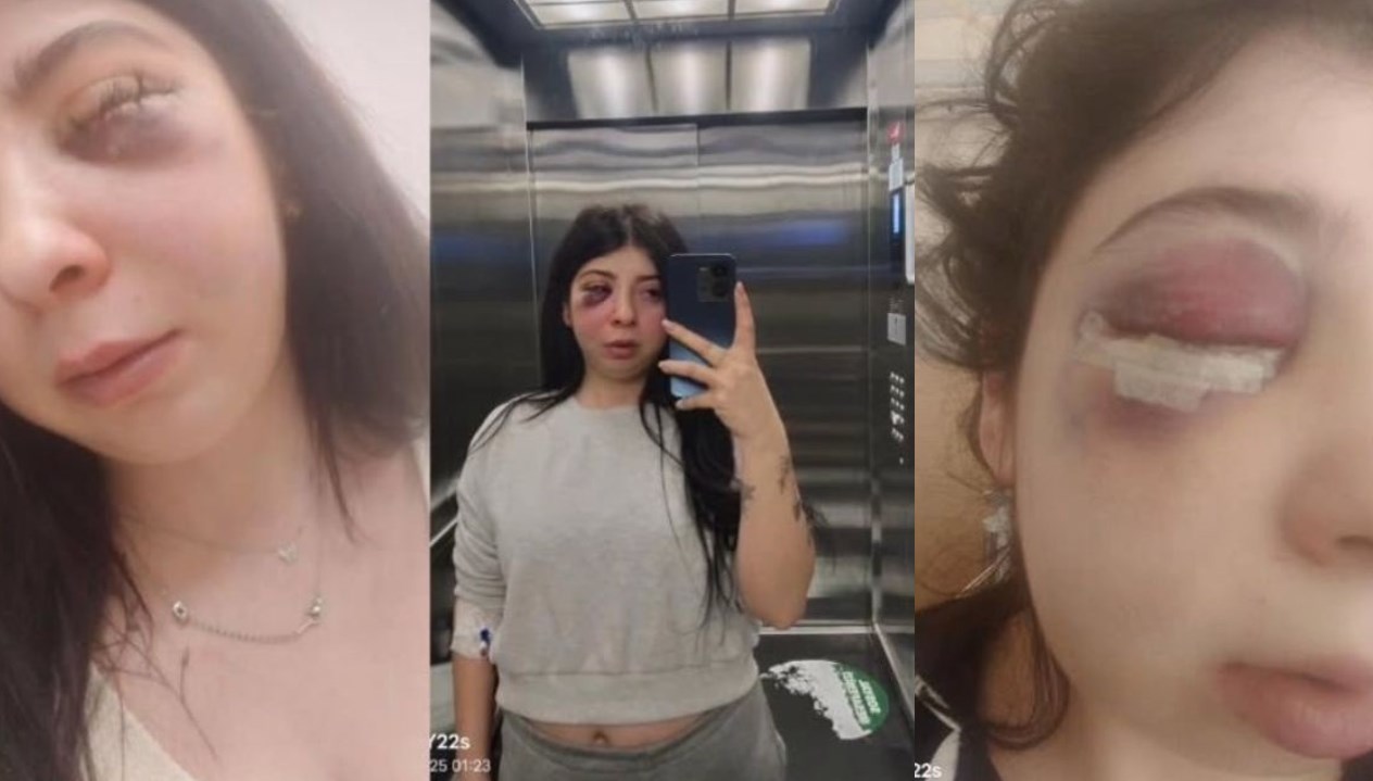 Sokak Terörü Diyeti: Tacizin Ardından Damla'nın Üç Aylık Sıvı Beslenme Mücadelesi 71 sokak ortasinda evvel kelamli taciz sonra hucum damla uc ay yalnizca siviyla beslenecek