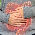 uzmani acikladi kalin bagirsak kanseri genclerde neden artti gAZdAsJd