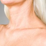 uzunlugundaki kirisikliklar nasil onlenir 40li yaslariniza girmeden evvel boyun cizgilerini yok edin 3xBztSSQ