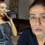 yildiz tilbenin yuzunde yaniklar olusmustu son durumunu acikladi OQLvhTh1