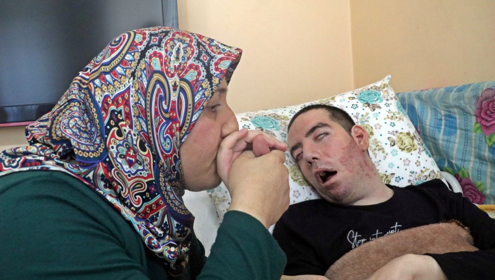 13 yil gozlerini hic kapatamadi sesi kisik kaldi sspe hastasi gencin aci oykusu jh7yhp8s