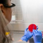 151 kisinin vefatina neden olan salgin tasa yaratti yetkililer 3 belirtiye karsi uyariyor Ud9tAjUK