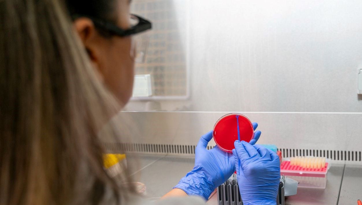 151 kisinin vefatina neden olan salgin tasa yaratti yetkililer 3 belirtiye karsi uyariyor Ud9tAjUK