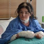 20 yildir parmaklarini kullanamiyordu amerikali arias turkiyede sifa buldu I7PDBjyb