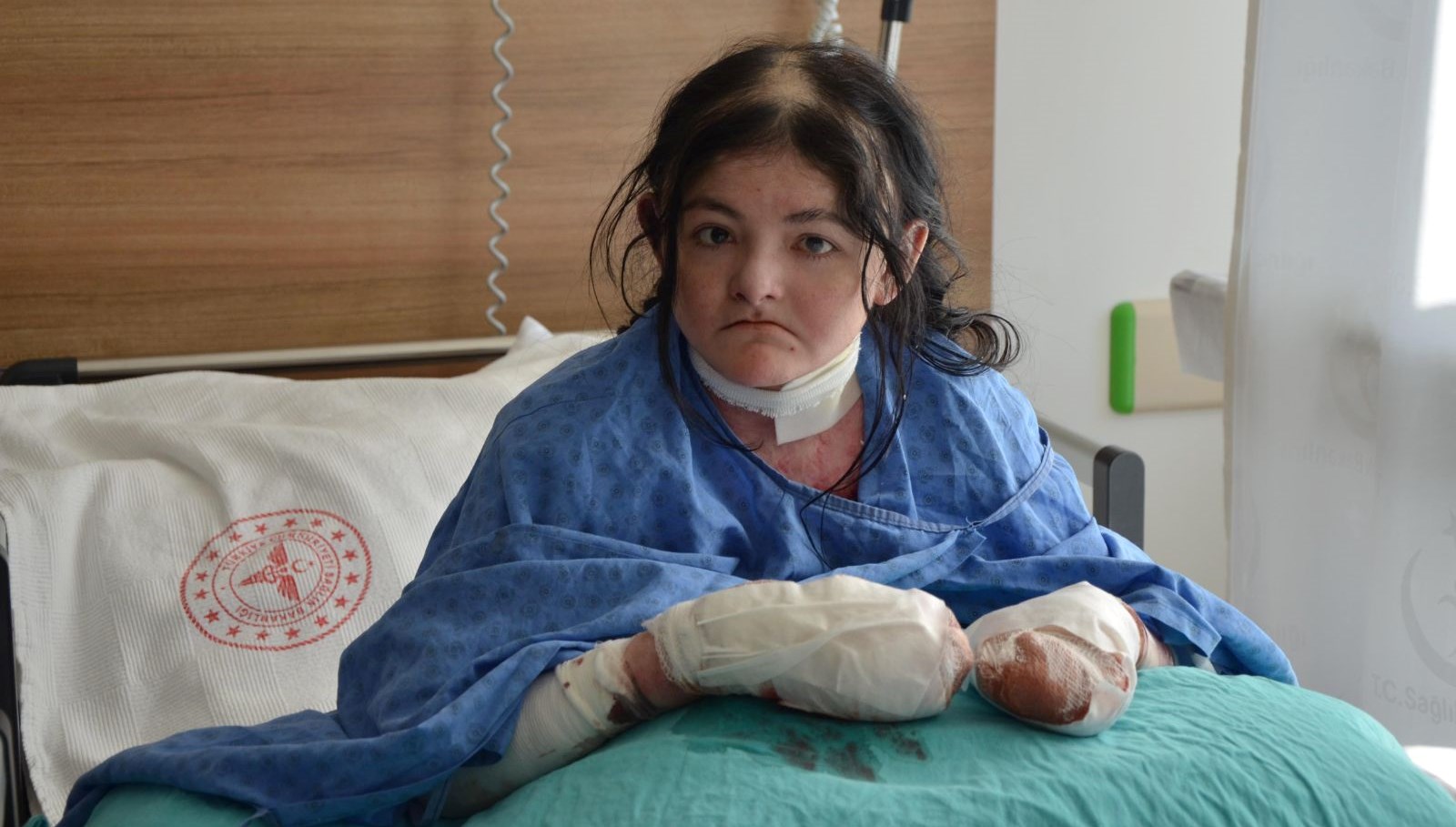 20 yıldır parmaklarını kullanamıyordu: Amerikalı Arias Türkiye'de şifa buldu 71 20 yildir parmaklarini kullanamiyordu amerikali arias turkiyede sifa buldu I7PDBjyb