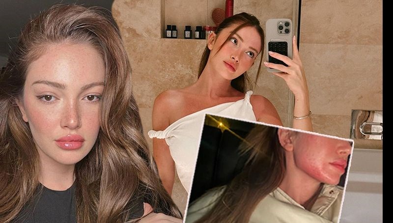 Danla Bilic darp fotoğrafını paylaştı | Eski sevgilisinin birinci sözü ortaya çıktı 71 danla bilic darp fotografini paylasti eski sevgilisinin birinci sozu ortaya cikti