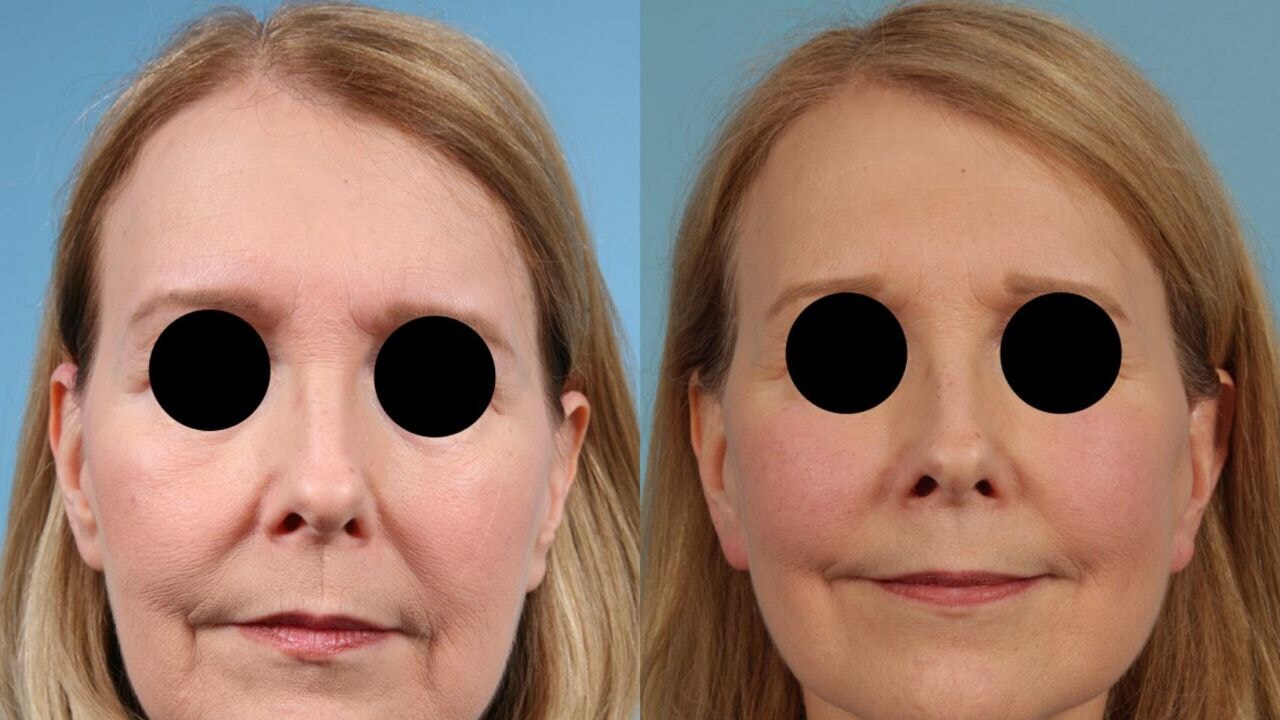 hastanelik eden zayiflama yontemi ozampik yuzu uyarisi Jm3m1tQZ