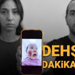 iki yasindaki bebege kreste dayak yuzu parcalanmisti morluk icindeydi ASXiZqF6