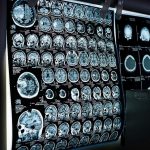 istanbulda 81 bini askin sahsa fiyatsiz kanser taramasi mS7FP3Cx