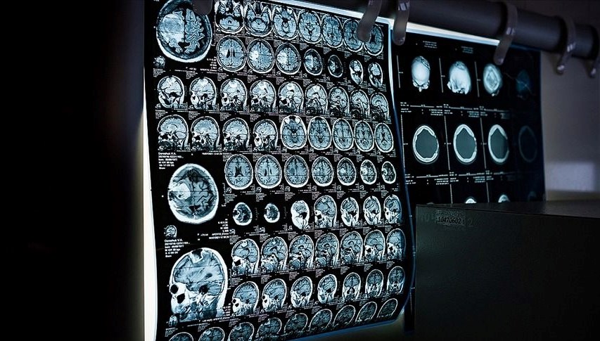 İstanbul'da 81 bini aşkın şahsa fiyatsız kanser taraması 71 istanbulda 81 bini askin sahsa fiyatsiz kanser taramasi