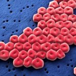 jinekologlar uyardi et yiyen cinsel organ enfeksiyonu JQ1hEyNE