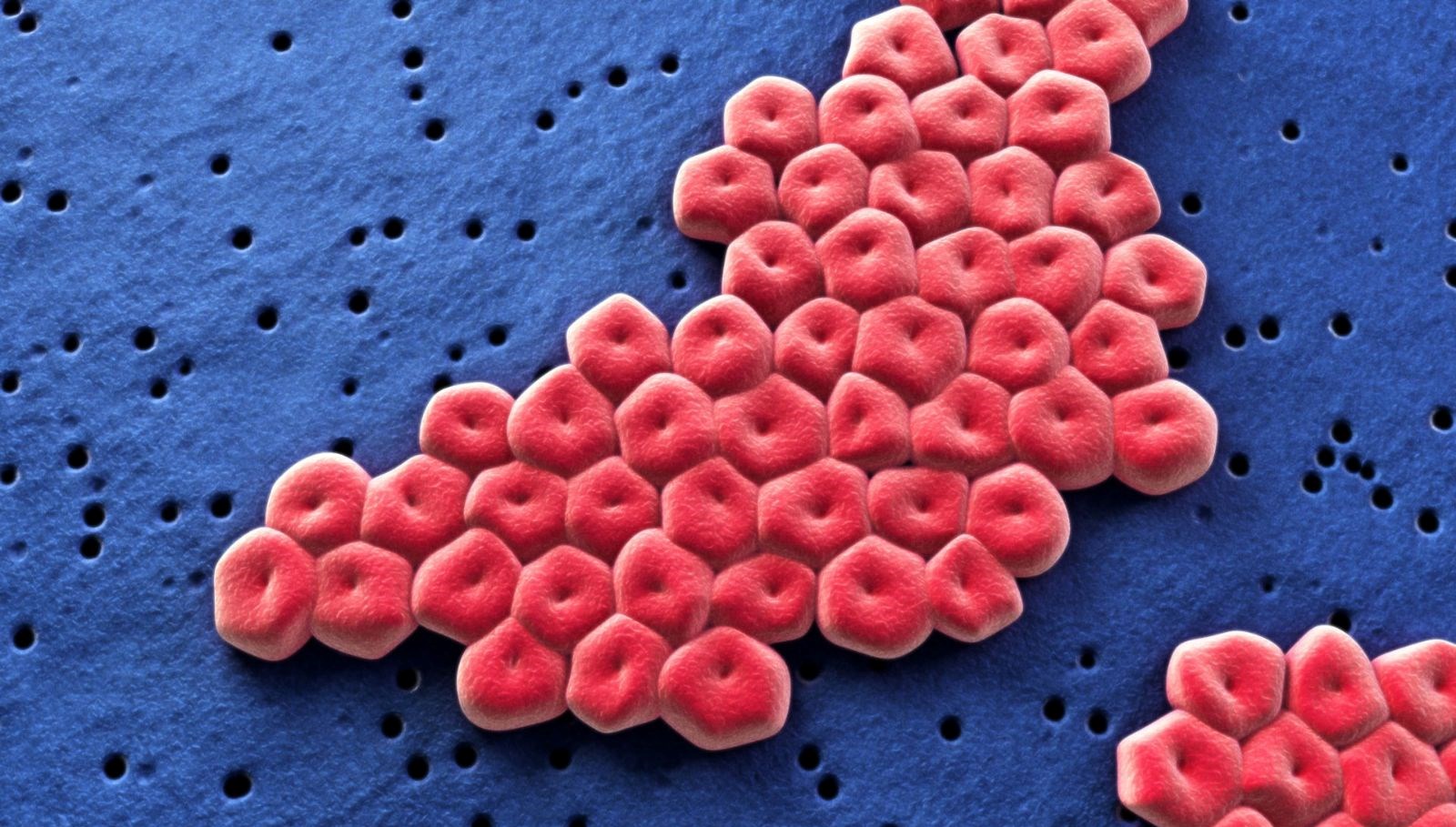 jinekologlar uyardi et yiyen cinsel organ enfeksiyonu JQ1hEyNE