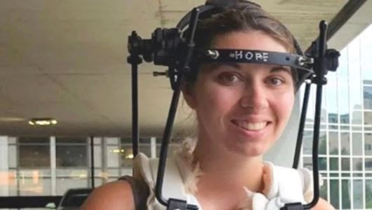 Kafatası omurgasından ayrılmak üzereydi: 37 ameliyat geçirdi 71 kafatasi omurgasindan ayrilmak uzereydi 37 ameliyat gecirdi