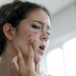 karaciger kanseri isareti olabilir uzmani ciltte ortaya cikan belirtilerini acikladi GRkBZyy7