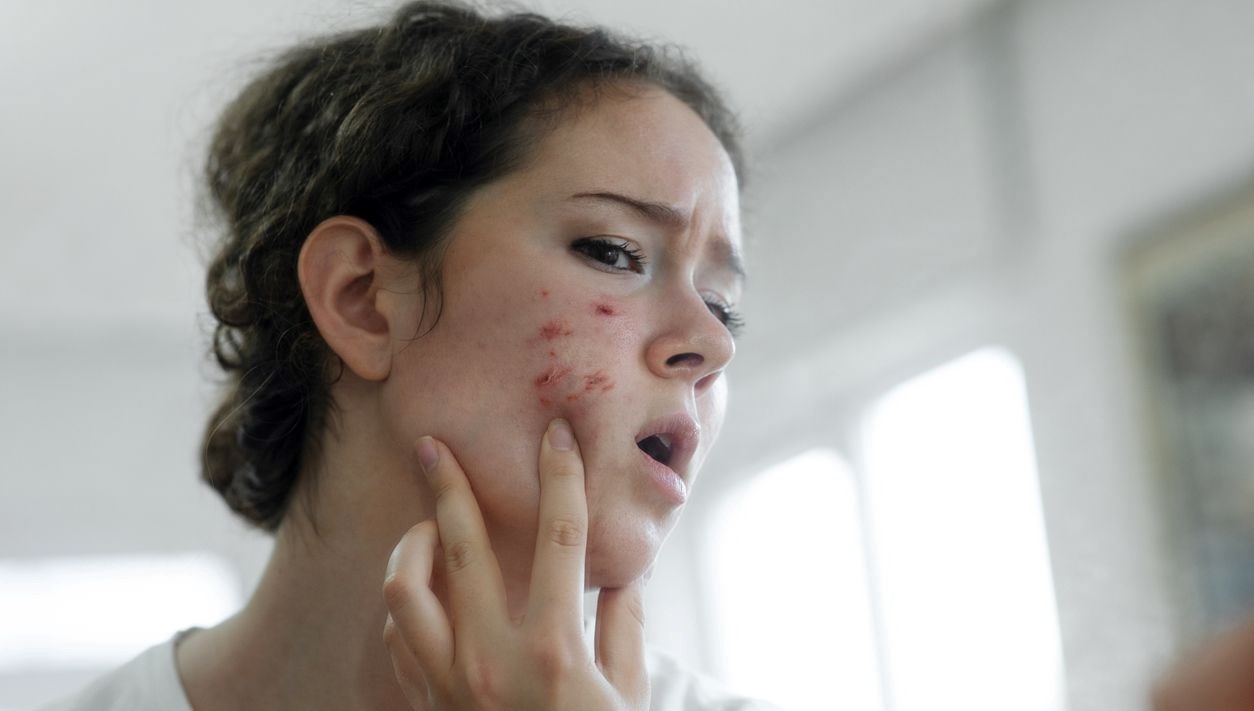 karaciger kanseri isareti olabilir uzmani ciltte ortaya cikan belirtilerini acikladi GRkBZyy7