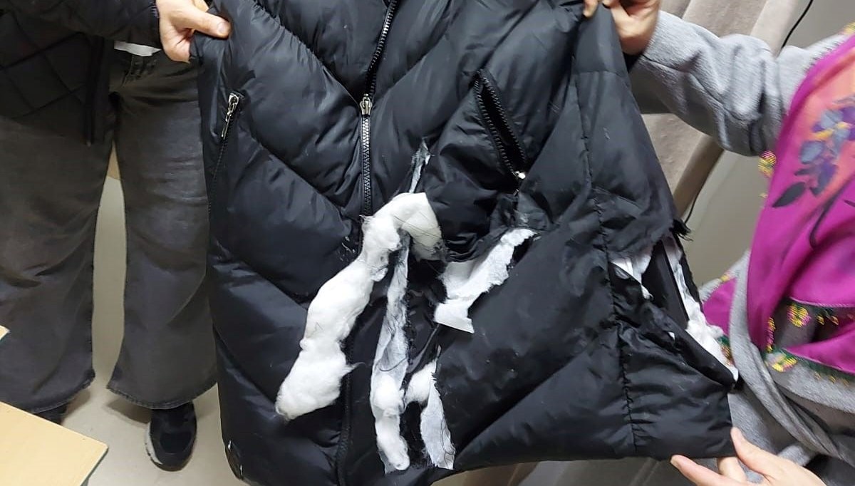 kopeklerin saldirisina ugrayan bayan yaralandi U4Kp1pb7