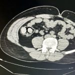 midelerinden 10 modul uyusturucu cikti 2 kisi tutuklandi LscKffWT