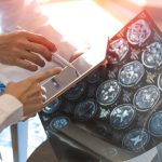 noroloji uzmani uyariyor agir covid 19 gecirenler risk altinda dzPPI1fL