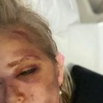 pedofili milyarder epstein kurbani bayan kaza gecirdi sayili gunum kaldi Ff9sWrKu