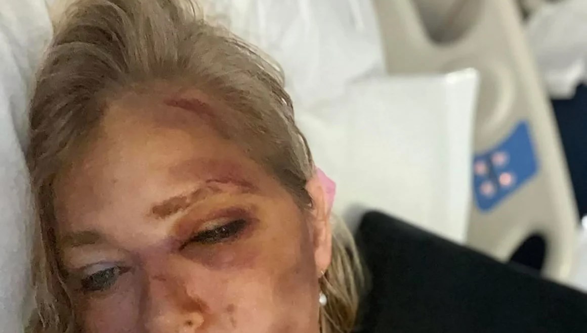 pedofili milyarder epstein kurbani bayan kaza gecirdi sayili gunum kaldi Ff9sWrKu