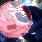 prostat kanserinde yeni teshis tukurukle tespit ediliyor CK8l8EEd