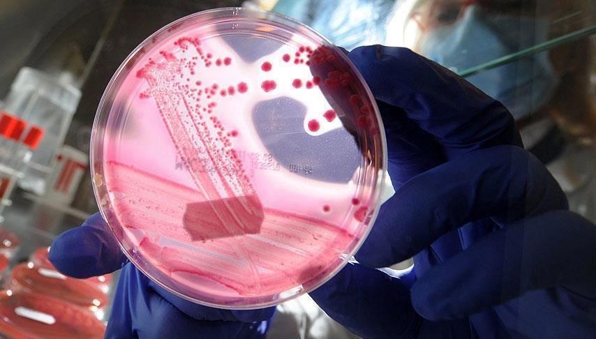 prostat kanserinde yeni teshis tukurukle tespit ediliyor CK8l8EEd