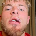 samsunspordandrongelenin son durumu hakkinda aciklama B1rILjai