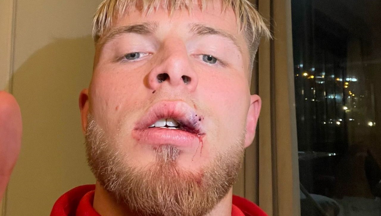 samsunspordandrongelenin son durumu hakkinda aciklama B1rILjai